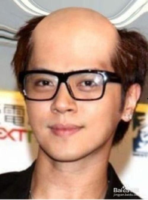 秃头男明星,揭秘秃头男明星的独特风采