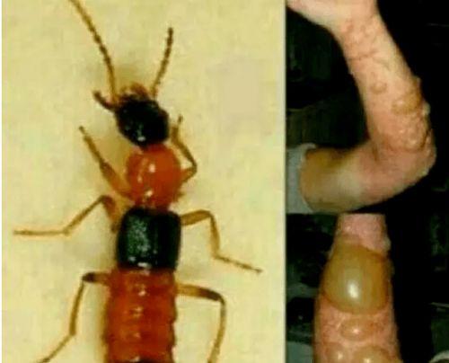 昆虫学者皮肤爆料视频,皮肤爆料视频背后的昆虫奥秘