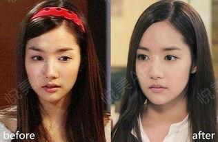 明星隆下巴图,明星蜕变之路揭秘