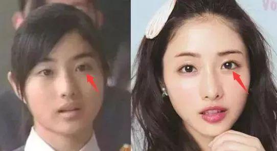 韩国和日本整容那个好,一场美丽艺术的较量